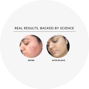 Vitamin C Brightening Serum