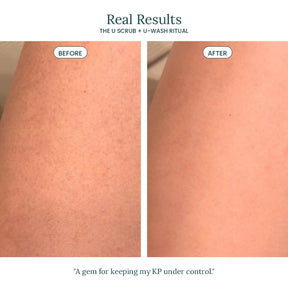 U-scrub Exfoliator