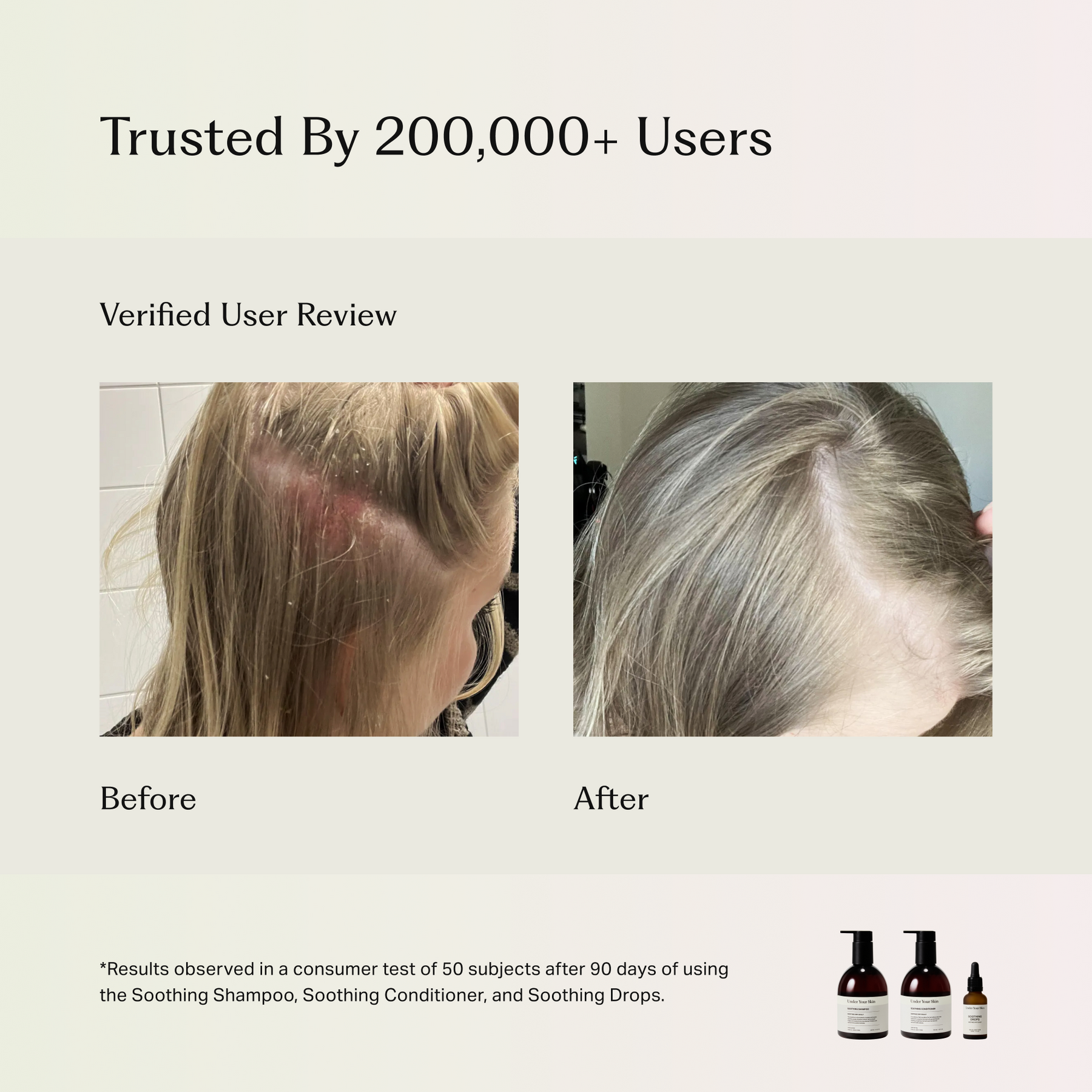 Soothing Scalp Treatment Drops