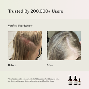 Soothing Scalp Treatment Drops