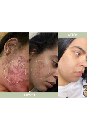 Dark Spot Correcting Cream