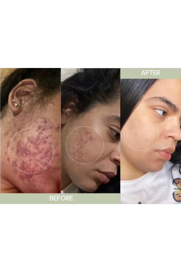 Dark Spot Correcting Cream