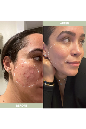 Come Correct Serum