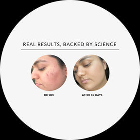 Vitamin C Brightening Serum