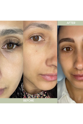 Eye Rewind Brightening Serum